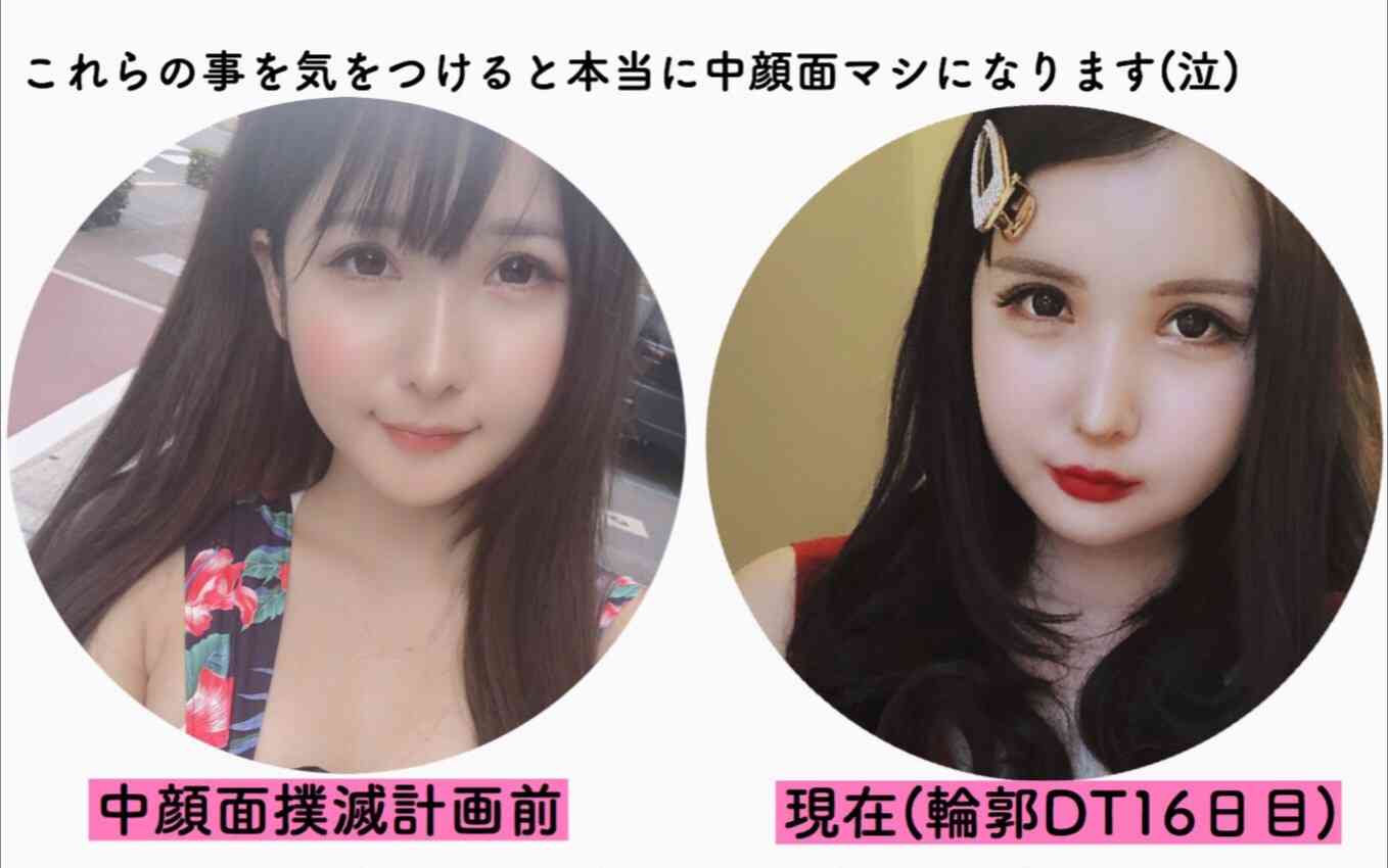 整形SNS美女、手術費1500万円　きっかけは父の一言「お前の顔は他人を不幸にする」