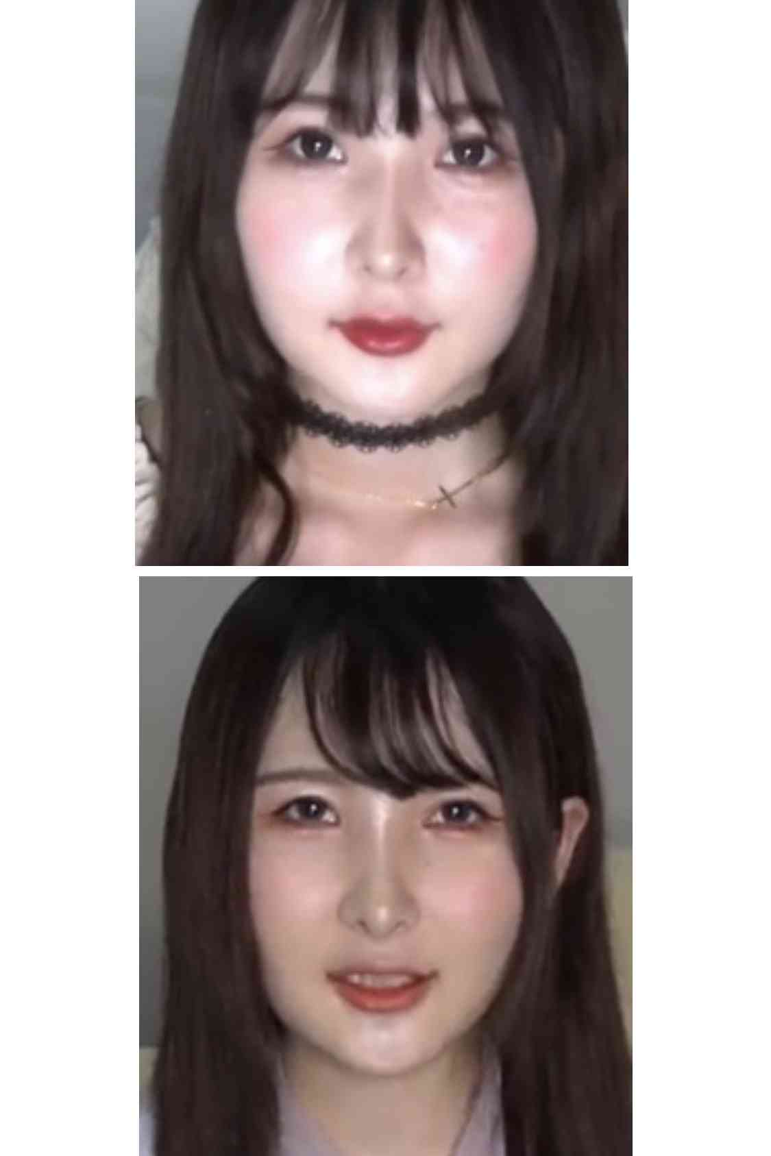 整形SNS美女、手術費1500万円　きっかけは父の一言「お前の顔は他人を不幸にする」