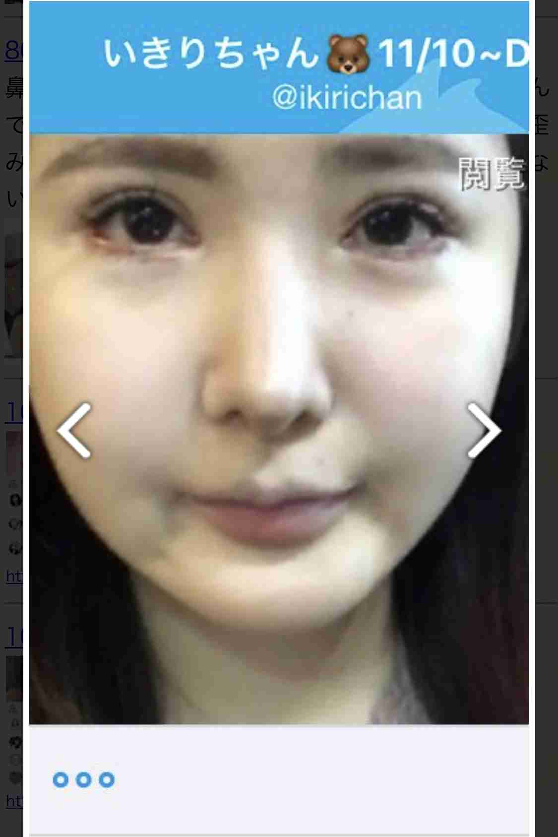 整形SNS美女、手術費1500万円　きっかけは父の一言「お前の顔は他人を不幸にする」