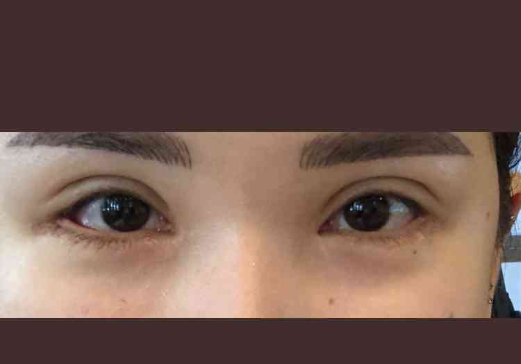 整形SNS美女、手術費1500万円　きっかけは父の一言「お前の顔は他人を不幸にする」