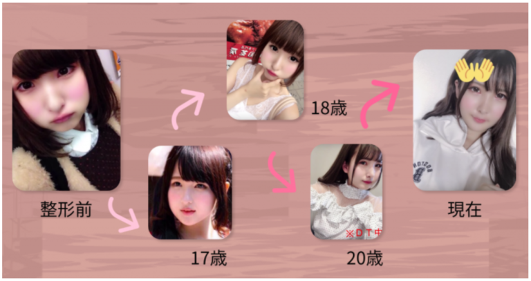 整形SNS美女、手術費1500万円　きっかけは父の一言「お前の顔は他人を不幸にする」