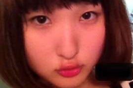 整形SNS美女、手術費1500万円　きっかけは父の一言「お前の顔は他人を不幸にする」