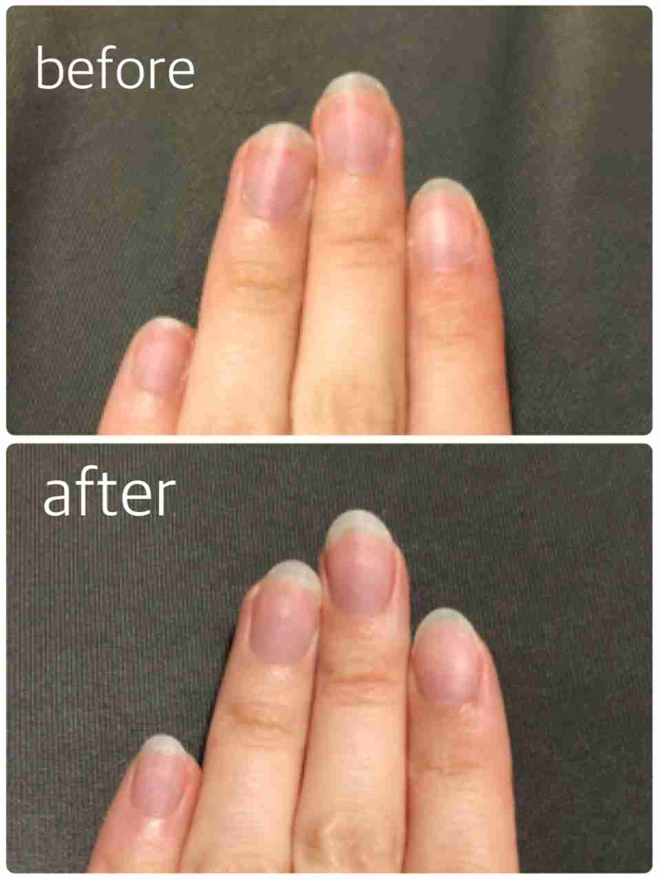 1ヶ月間 自爪育成するトピ ガールズちゃんねる Girls Channel