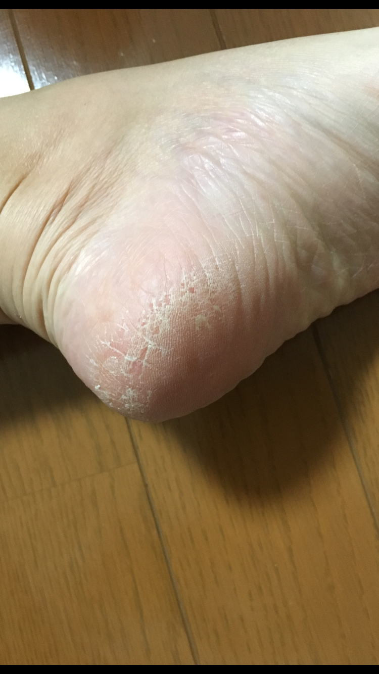 最近反省したこと