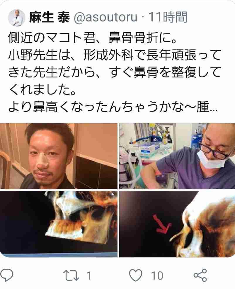 高須克弥院長　手術中の女性をインスタに投稿の東京美容外科に大激怒！投稿者は謝罪