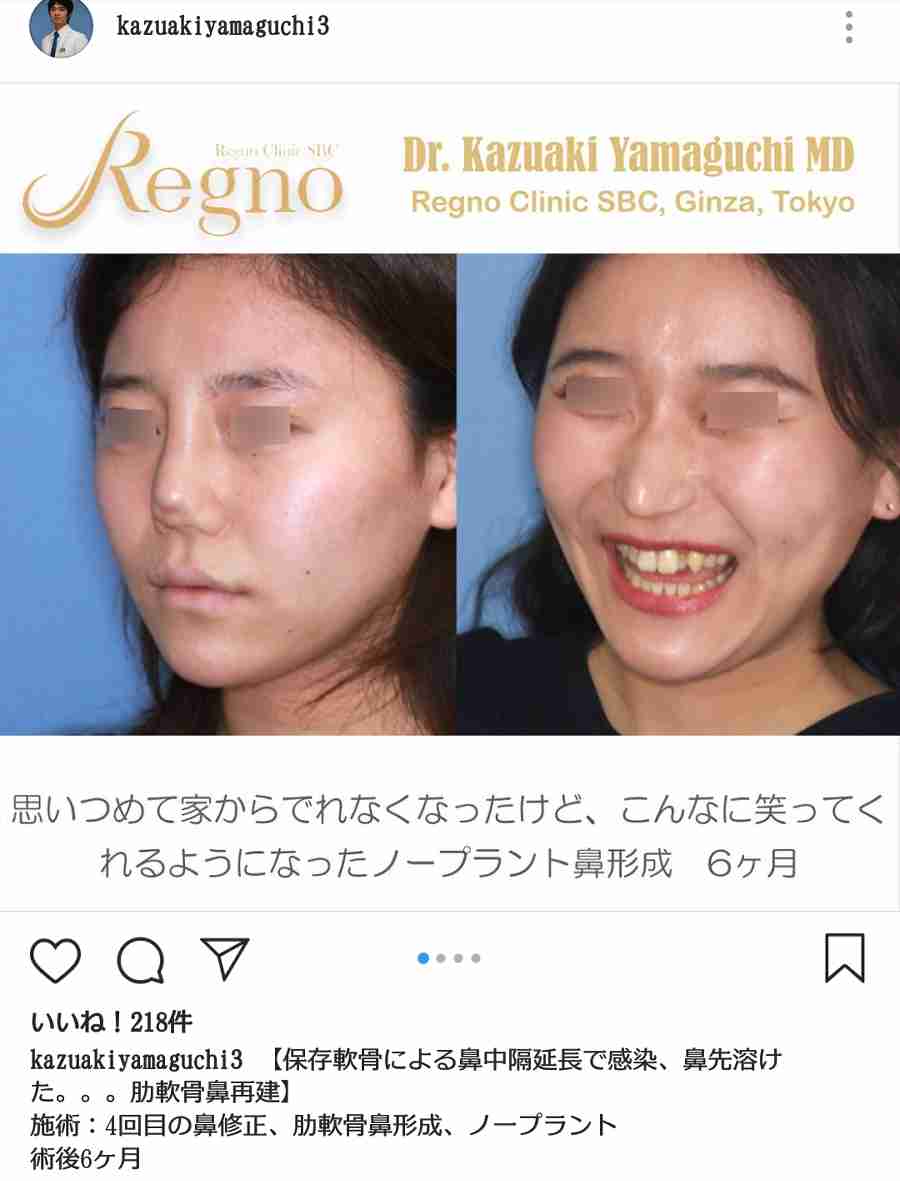 高須克弥院長　手術中の女性をインスタに投稿の東京美容外科に大激怒！投稿者は謝罪
