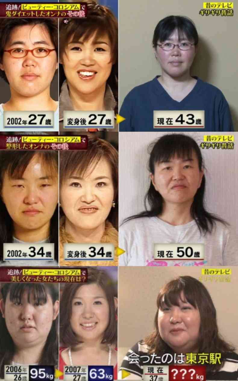 高須克弥院長　手術中の女性をインスタに投稿の東京美容外科に大激怒！投稿者は謝罪