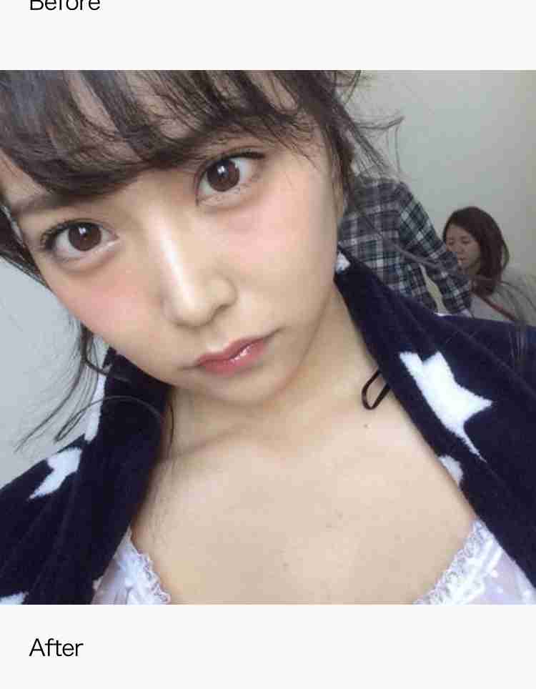 もはやタブーじゃない!?美容整形をしたら約8割は「カミングアウトOK」らしい