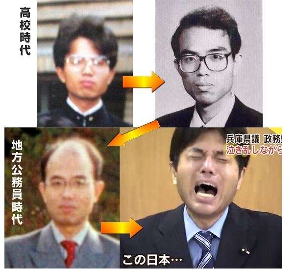 もはやタブーじゃない!?美容整形をしたら約8割は「カミングアウトOK」らしい