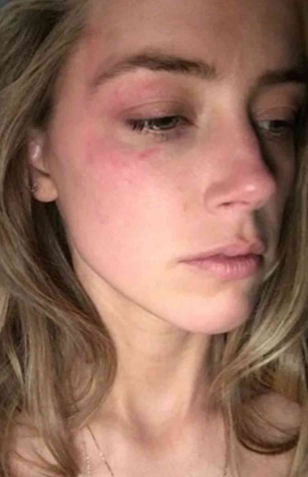 元妻、ジョニー・デップの薬物乱用による暴力主張