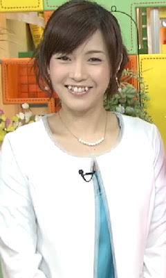 吉田明世アナ、歯の矯正に100万円以上!某局の面接で「その歯はどうするつもりですか?」