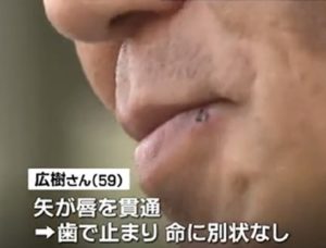 父親に向けボウガン発射 29歳の男逮捕 「父親を嫌っていた」