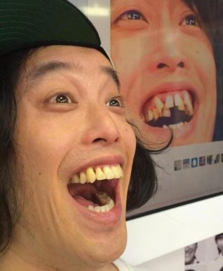 【心】歯並びが悪すぎて疲れる【体調】