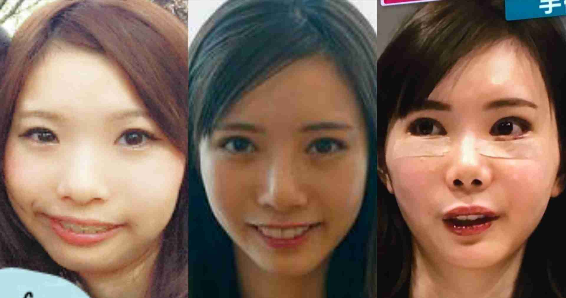 整形告白の有村藍里「全然満足していない」現在の葛藤&最新の美容事情を明かす