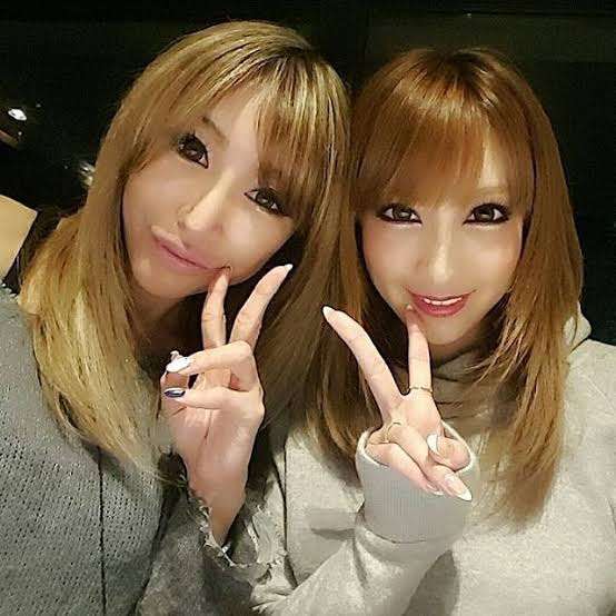 整形告白の現役キャバ嬢社長・桜井野の花の覚悟、「自分が子どもを生むことはない」