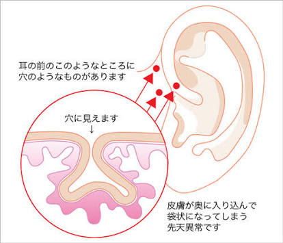 【閲覧注意】角栓、耳かき動画好きな人 Part2