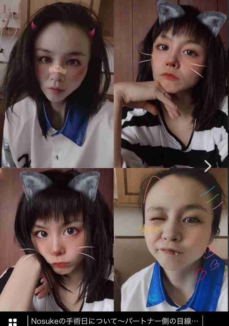 misono　手術後のNosukeに「さらに変わり果てた姿」、金銭面も限界