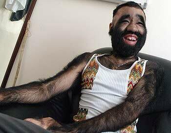 毛深い男性ってどこまでなら許容できますか ガールズちゃんねる Girls Channel