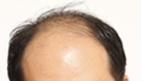 有名人の顔のパーツだけで誰かを当てるトピ!!