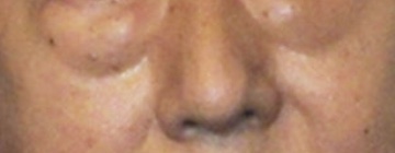 有名人の顔のパーツだけで誰かを当てるトピ!!