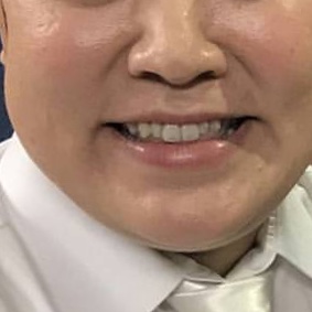 有名人の顔のパーツだけで誰かを当てるトピ!!
