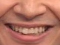 有名人の顔のパーツだけで誰かを当てるトピ!!