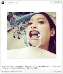 何故こんな風に撮ったんだろうという芸能人の写真を挙げていこう