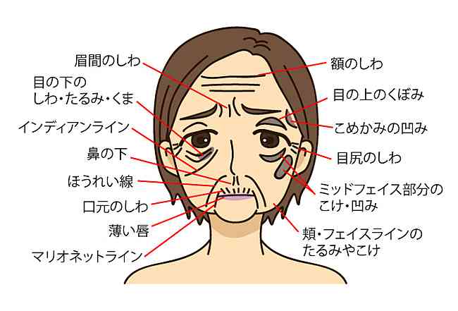 眉間のシワ対策 何してますか ガールズちゃんねる Girls Channel