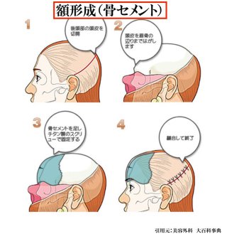 Mattの顔面進化は“整形なし”で可能なのか？  高須克弥院長が詳しく解説！