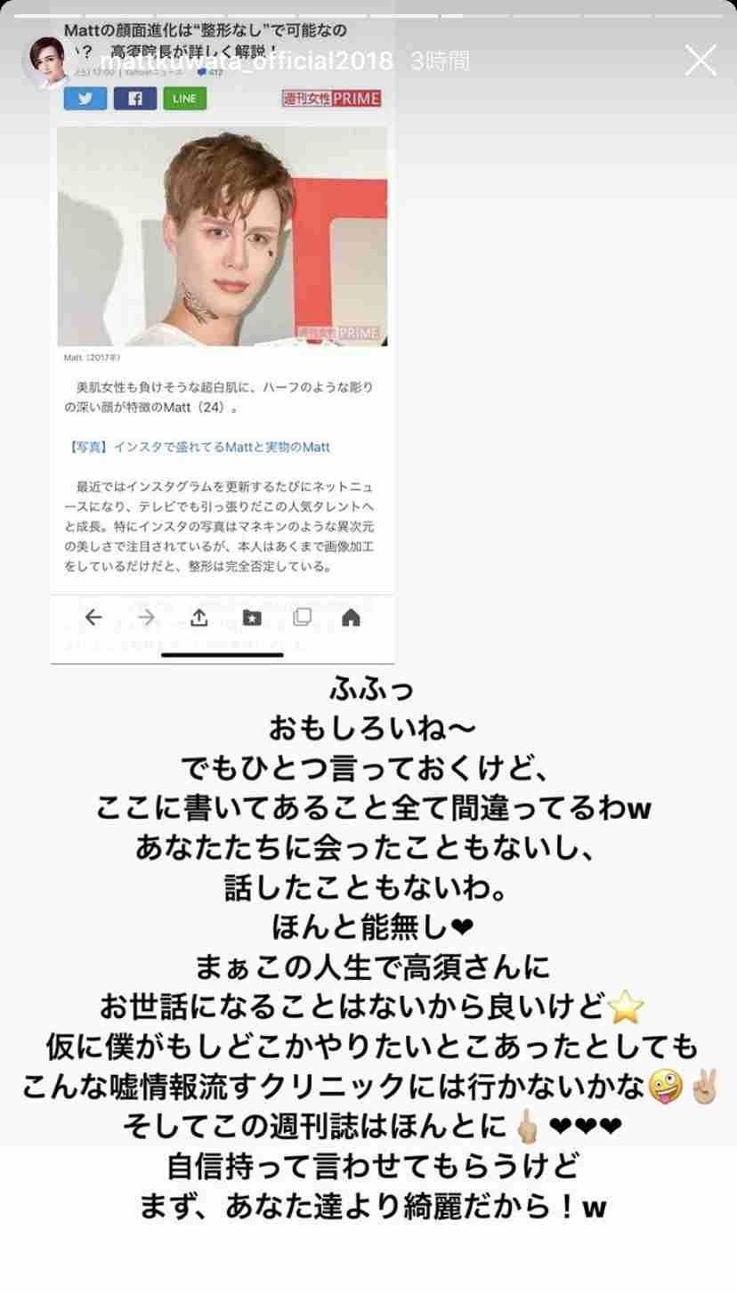 Mattの顔面進化は“整形なし”で可能なのか？  高須克弥院長が詳しく解説！