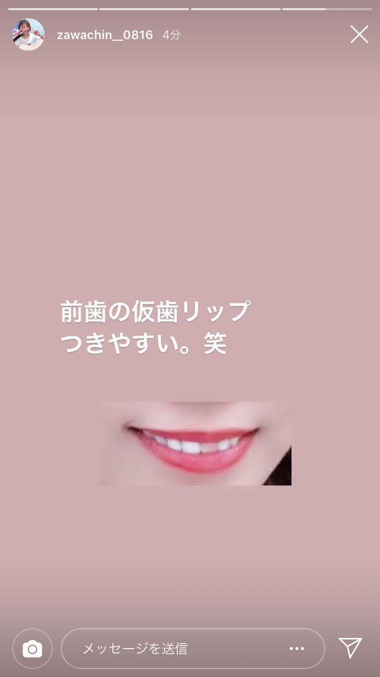 ざわちん、引地敬澄との“カップル風”2ショットに「美男美女」「横顔も可愛すぎ」の声