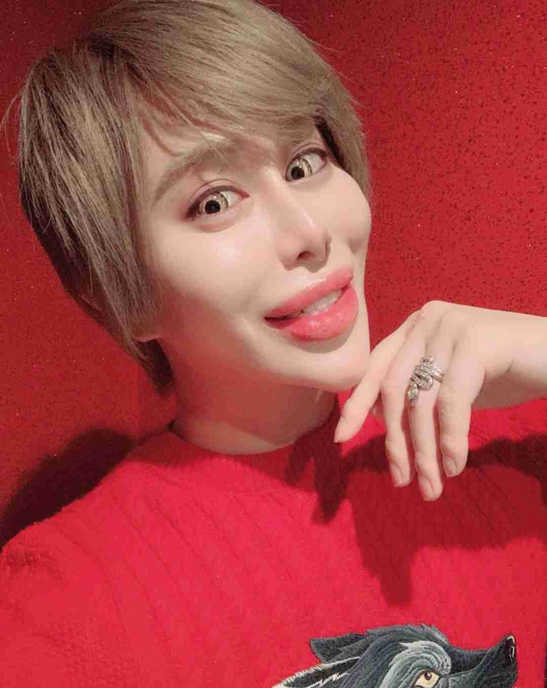 整形に9000万円！ 整形男子アレン、顔の激変と決意のワケを明かす
