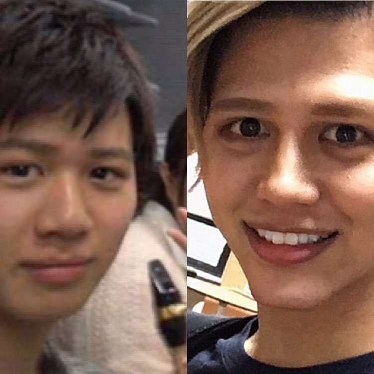 整形に9000万円！ 整形男子アレン、顔の激変と決意のワケを明かす