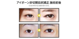 美容外科のおすすめ
