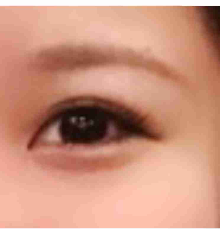 美容外科のおすすめ