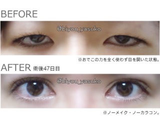 美容外科のおすすめ