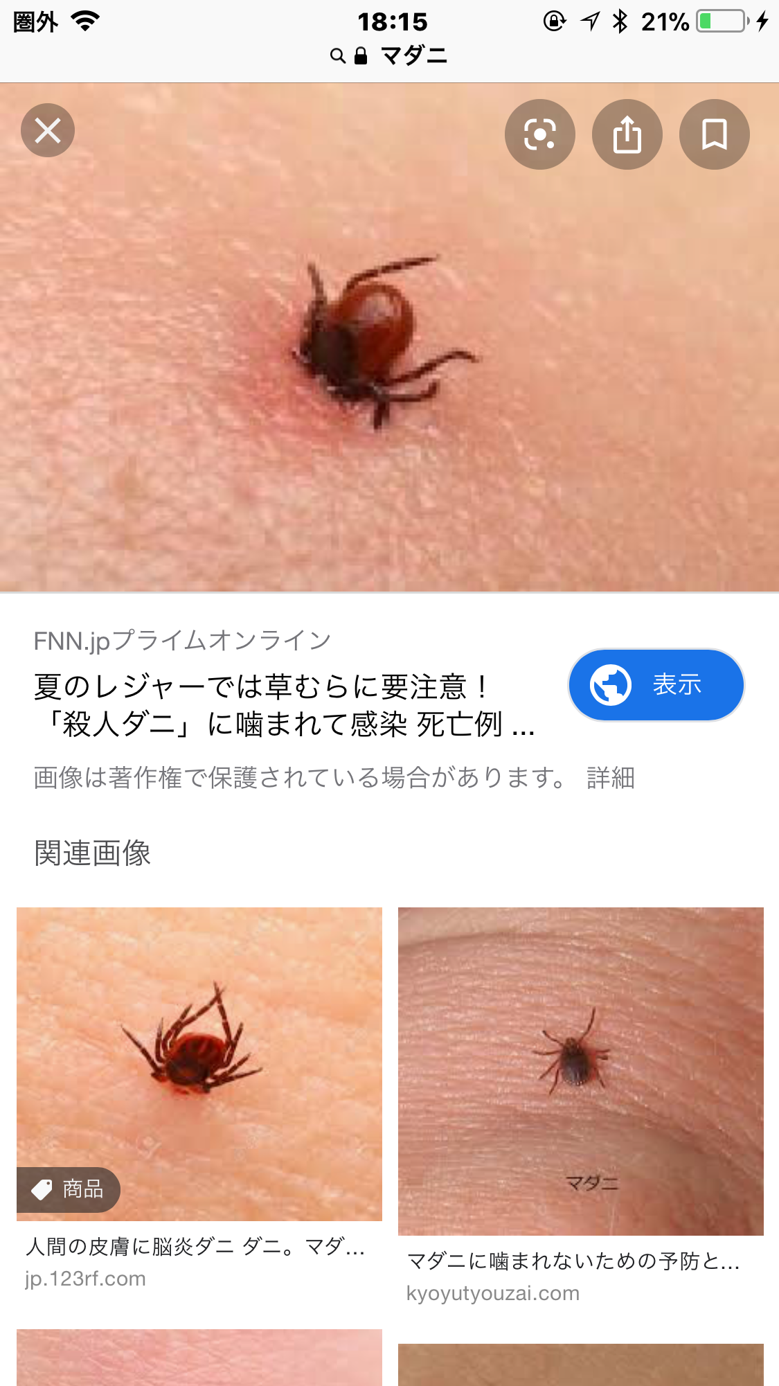 マダニに咬まれて女性死亡　日本紅斑熱を発症　肌の露出に注意　静岡・伊豆の国市