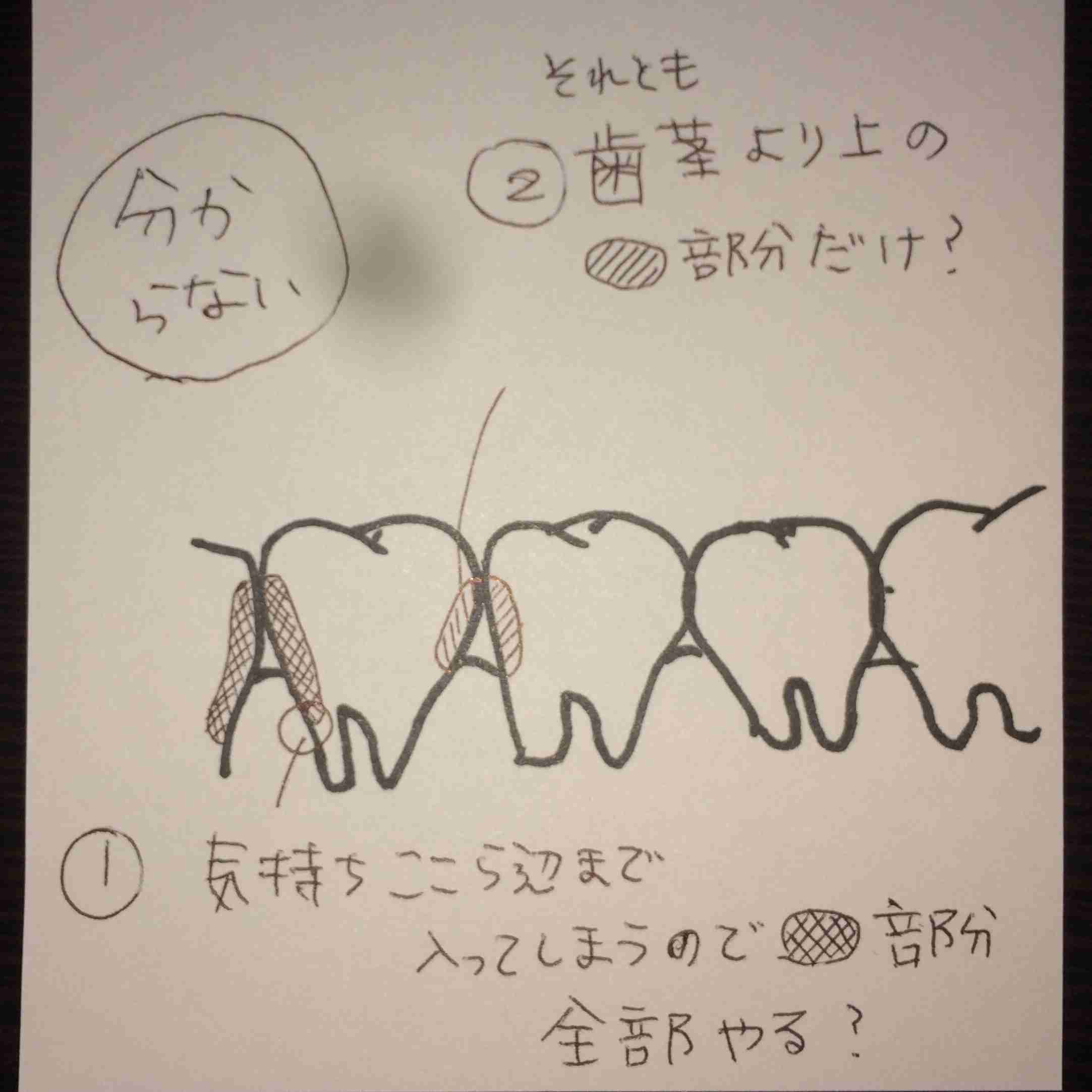 【歯】歯間ブラシやデンタルフロスしてますか？【お手入れ】