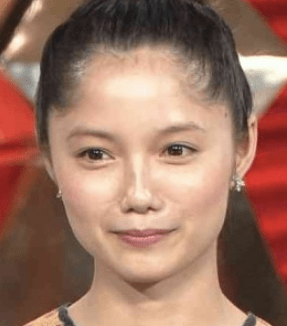 双子モデル・吉川ちえ、鼻の整形手術を報告　整形総額は700万超に