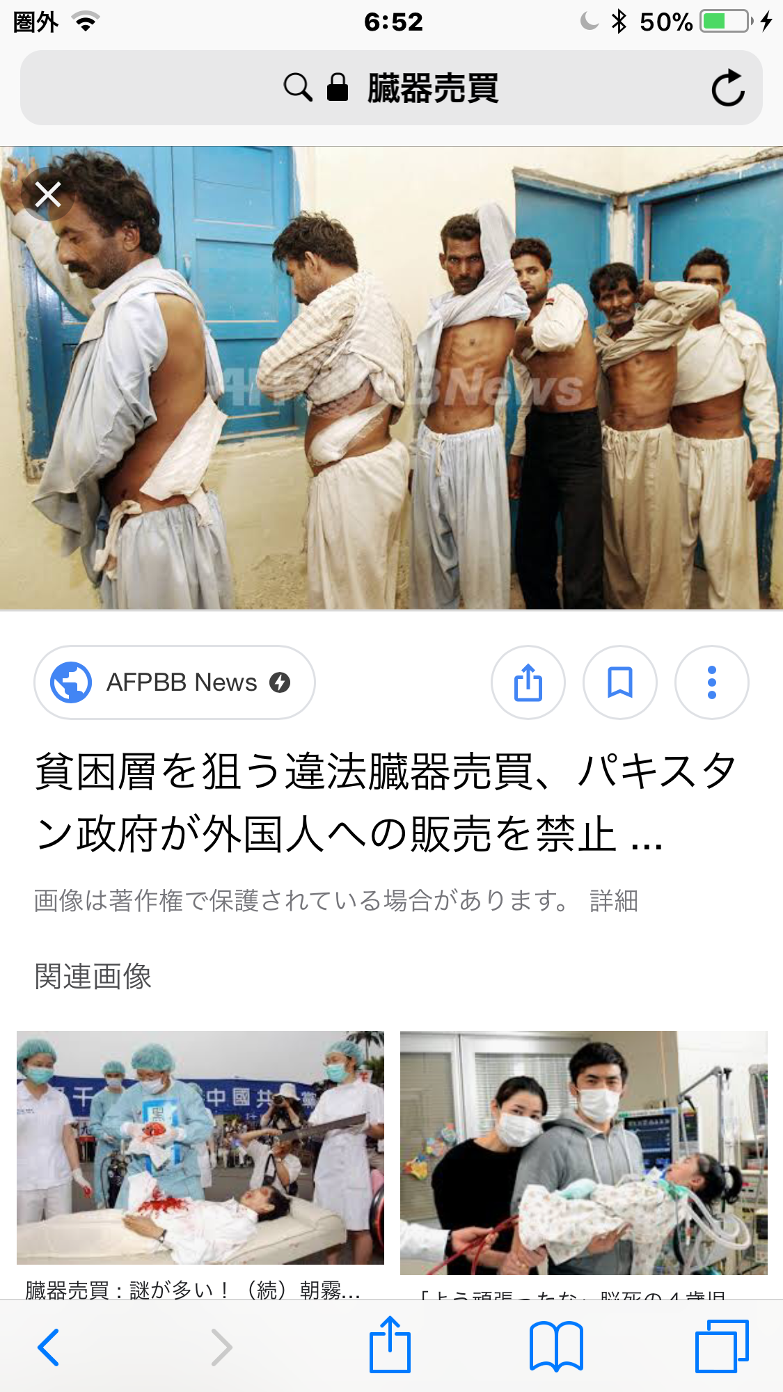 前澤友作氏の心臓移植支援に「他国の移植心臓を金で奪った」