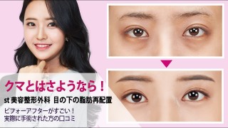 整形のダウンタイム中の方、整形済みの方
