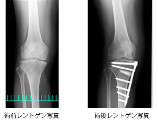 O脚さん、全員集合〜!