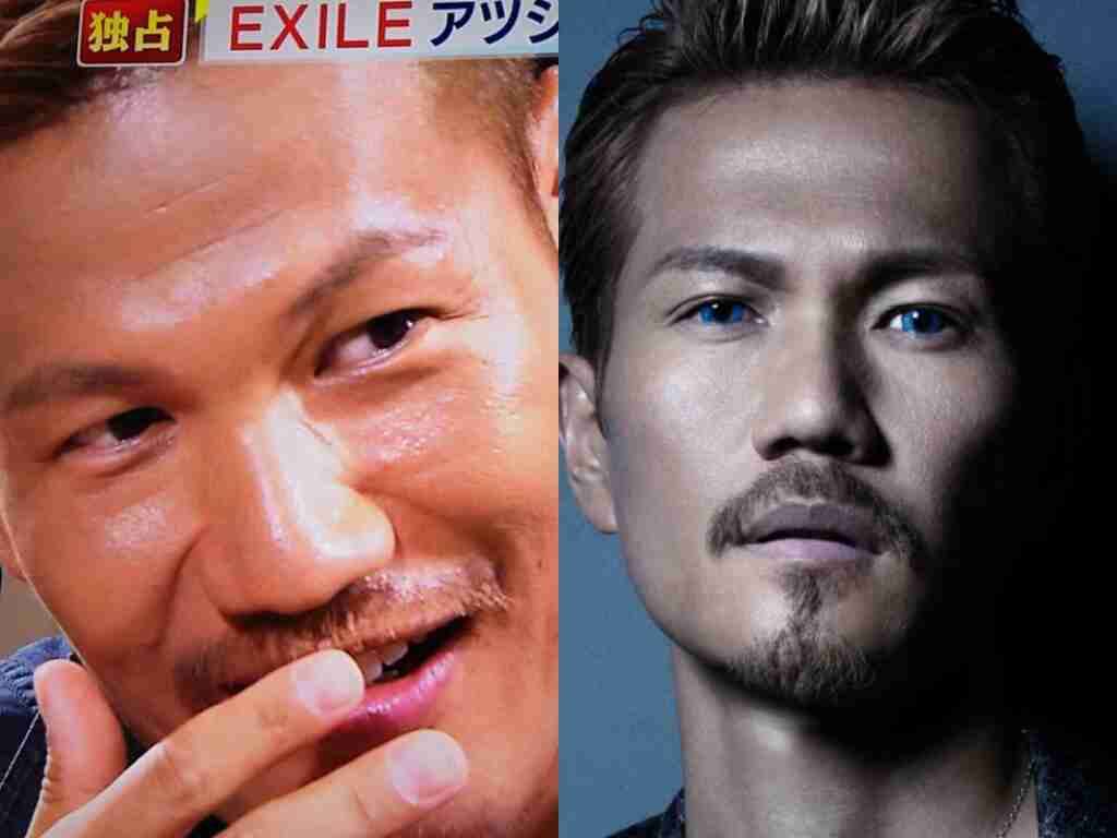 正直整形かな？と思う男性芸能人