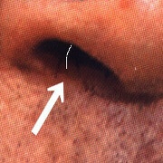 他人の白髪を指摘しますか？