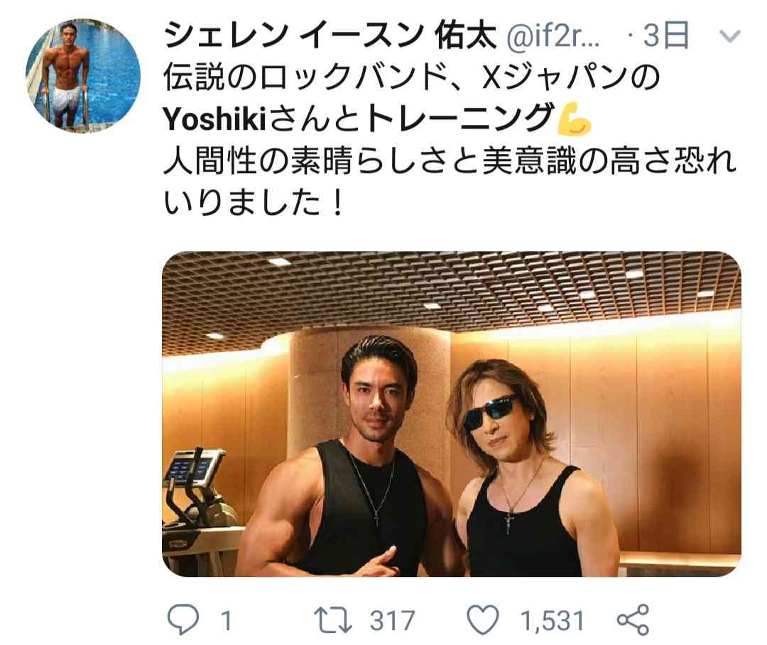 YOSHIKI、ファンと触れ合い右手首の状態悪化 ドクターストップも公演続行