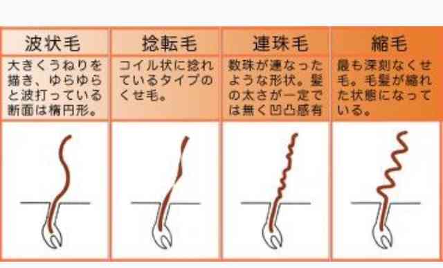 髪の毛の悩み