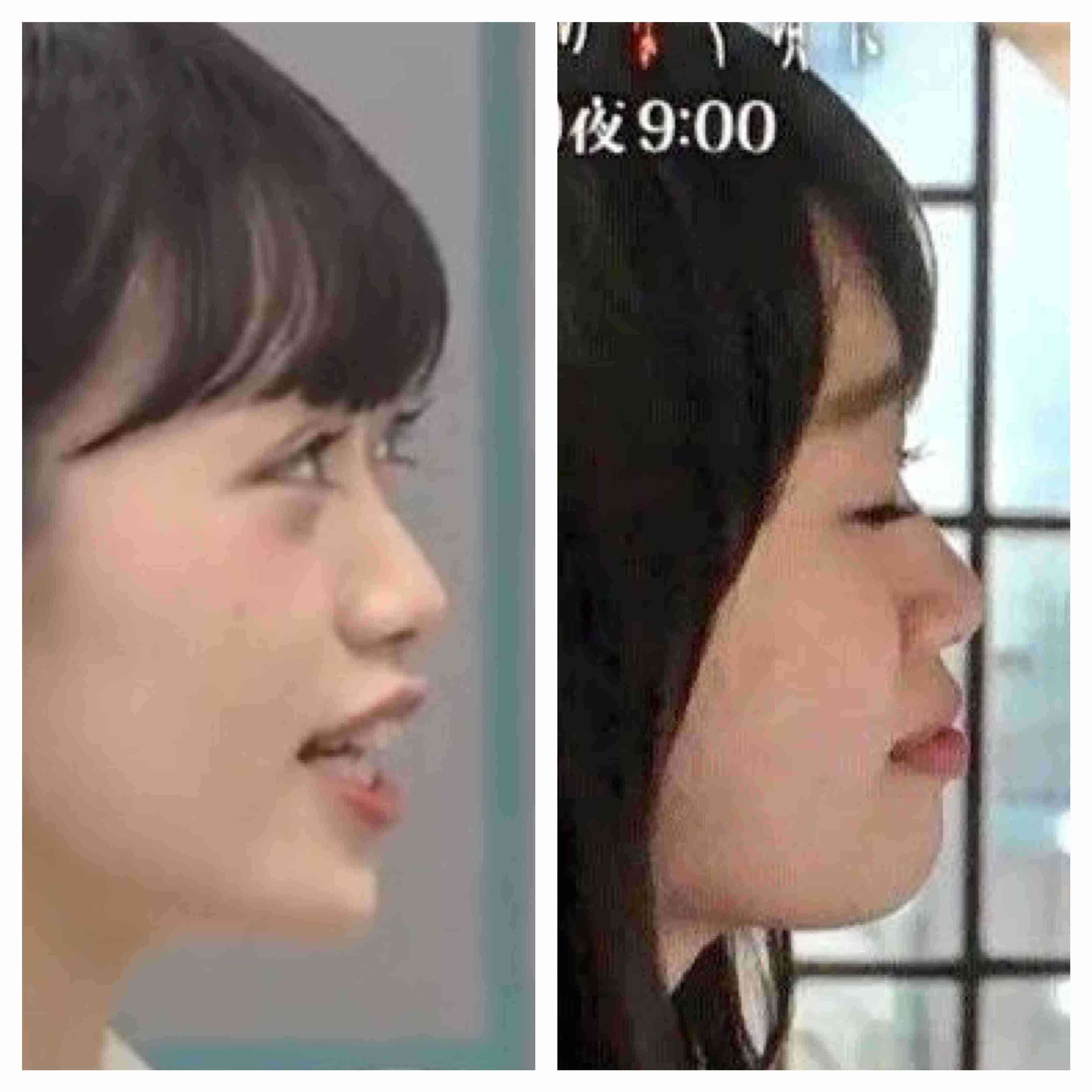 NGT中井りか、運営への思い投稿「少ないアイドル人生の時間奪わないでくれ」