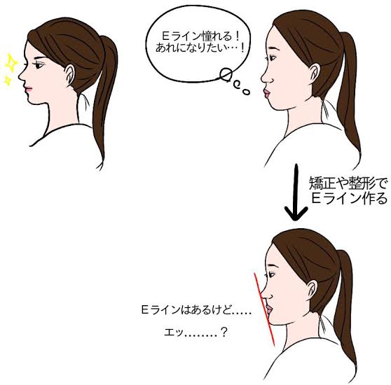 口ゴボを直したい・直した人
