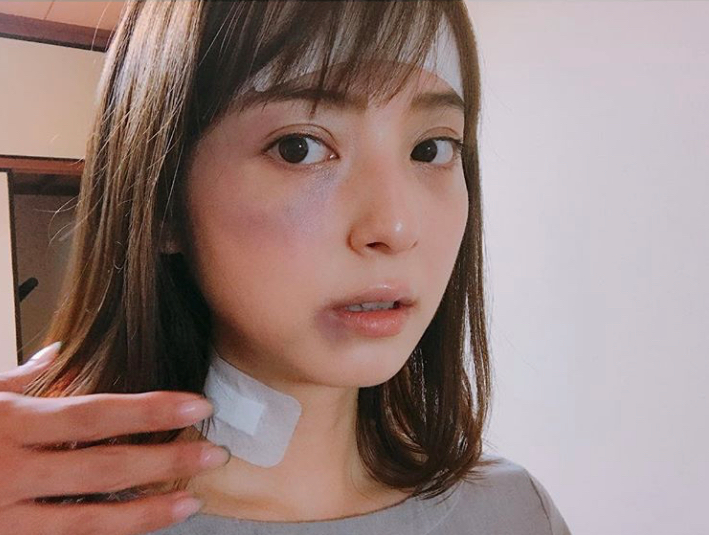 整形告白に驚いた女性芸能人10人