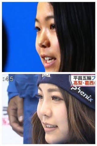 整形告白に驚いた女性芸能人10人